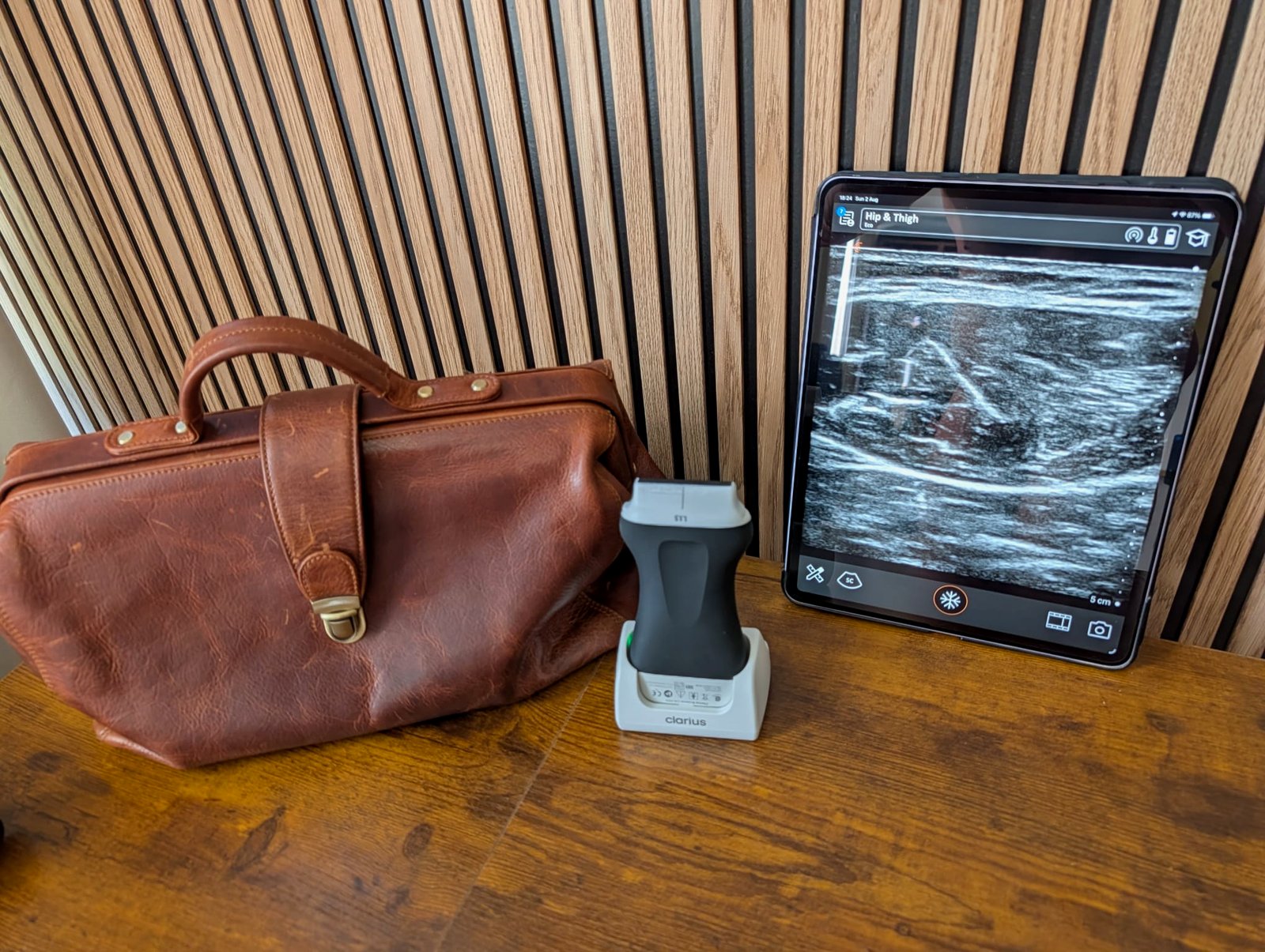Wireless ultrasound probe on its dock beside a tablet showing a live muscle scan, next to a leather doctor's bag